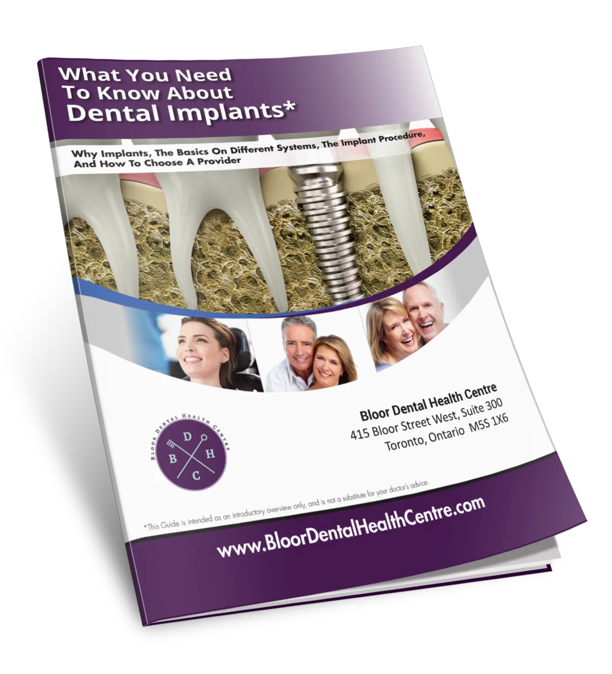 Download Our Free Guide for Dental Implants